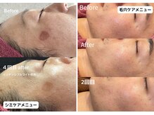 ビトタン(+美to鍛)の雰囲気（男性美容をトータルにサポート★目に見える変化に感動◎）
