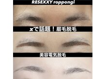 リゼクシー INTERNATIONAL麻布十番 六本木(RESEXXY)の雰囲気（Xで話題の眉毛脱毛！六本木店で施術可能！）