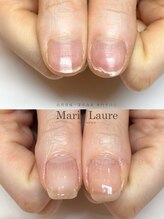 マリーロール 淀屋橋本店(Marie Laure)/深爪矯正/自爪育成/ネイルケア