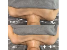 ベール(BEHL)/コルギのBefore After