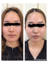 グランダム ローズ/