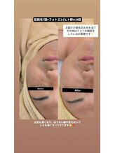 クレール 小山店(CLAIR)/【美肌フォト+エレポレ】