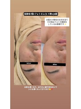 クレール 小山店(CLAIR)/【美肌フォト+エレポレ】