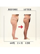 フェムビー 千葉駅前店(FEMBE)/痩身）60代の方の変化