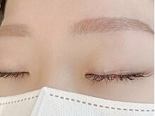 レレガンス(LELEGANCE)/下がり眉改善