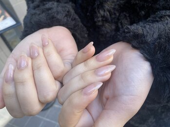 スキンカラーご用意あります