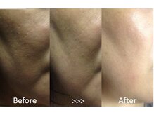 サロン ド 花歩 松山本店の雰囲気（美肌への改善は驚きの効果！お悩みの方はぜひご相談ください♪）