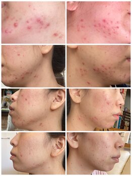 ヴィクトワール(Victoire)/ハーブトリートメント大人気です