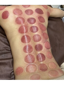 ラナ(Lana)/ご自身の不調を知るきっかけに