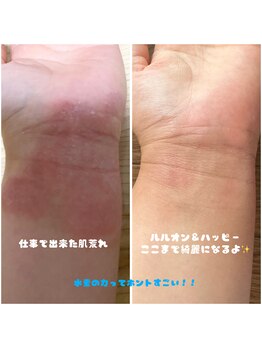 ヨサパーク マナ(YOSA PARK MANA)/ハーブ蒸しと水素で、、！