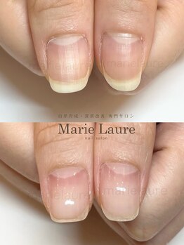 マリーロール 淀屋橋本店(Marie Laure)/自爪育成/深爪矯正/ネイルケア