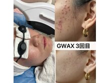 ジーワックス(G WAX)の雰囲気（アイブロウをご提案！美顔WAXも高性能美容機も肌悩み徹底改善♪）