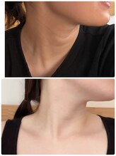 サロン シー(salon shhh...)/首に使用もおすすめ