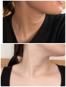 サロン シー(salon shhh...)/首に使用もおすすめ