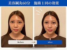 和ら/くま/眼精疲労/くすみ/むくみ