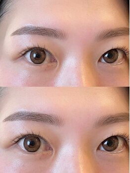 ラウレア(Laule'a)の写真/[顔のうぶ毛も眉も、まとめてすっきり整えるならこのセット]初めての方にもおすすめの人気メニューです。