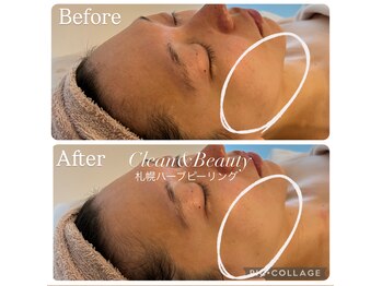 クリーンアンドビューティ 札幌(Clean&Beauty)/当日メイクOKの韓国発美容♪