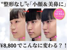 隆鼻矯正専門店 ラプリ(Raplit)