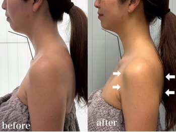 ベール(BEHL)/コルギのBefore After