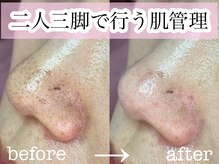 エミュ(emu)の雰囲気（お客様と二人三脚で行う肌管理！毎月ケアで肌育♪）