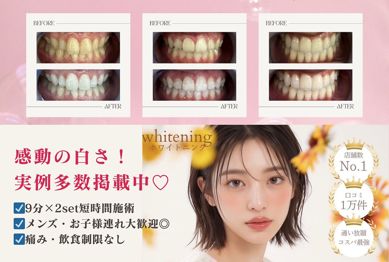 エクシアホワイトニング 津駅前店｜ホットペッパービューティー