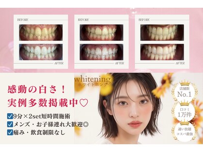 エクシアホワイトニング 津駅前店の写真