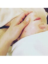 ソワン(Soin)/フェイスリフトの術後インディバ