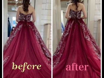 オージャス(OJAS)/【ブライダルエステ】