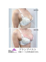 バイオビューティー 神戸本店(Bio Beauty)/プランプバスト　施術症例