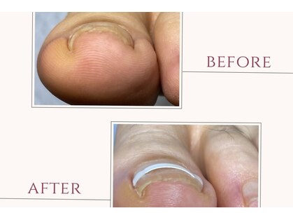 ドクターネイル爪革命 所沢西店の写真