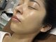 ララシエラ 新潟駅前店(LalaSierra)の写真/【ダクトピール導入記念クーポンあり♪】肌のターンオーバーを根本から整え改善しなかった肌悩みを解消◎