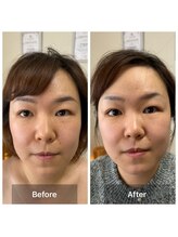サロン ド アヤ(salon de Aya)/一回施術だけでリフトアップ小顔