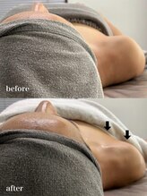 ベール(BEHL)/コルギのBefore After