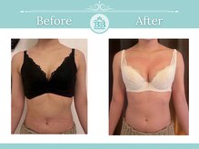 美人バスト 表参道店/【バストアップ/育乳 症例】