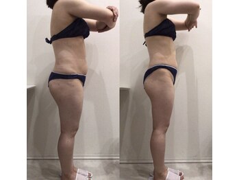 ルシアル 新宿代々木店(LUCIAL)/痩身オーダーメイド