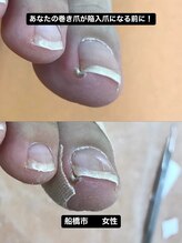 巻き爪じゅん 千葉駅前店/もう限界ではありませんか？