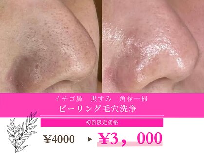 スムース イー(Smooth+E)の写真