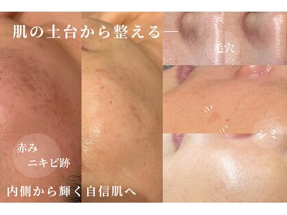スパレーカ(Spa laka)の写真