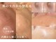 スパレーカ(Spa laka)の写真