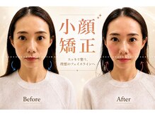 エモア メディカル整体院 恵比寿院(Emoa)