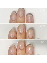 リモネイル(Rimo nail)/爪育成中