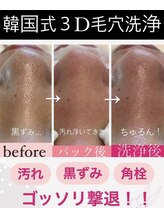 ダリア(Dahlia)/韓国式3D毛穴洗浄