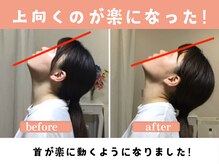 本八幡整体院やわらぎ/首の詰まりが楽になります