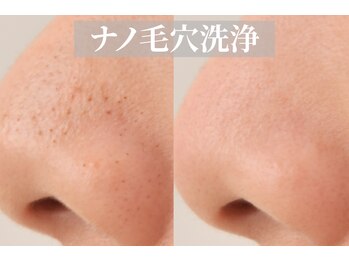 VS28スキンケアスタジオ バリイン 横浜(BALI IN)