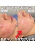 【8月限定★】うるおいチャージ×肌荒れレスキュー♪プラズマシャワー 3500円