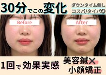 ラフテル鍼灸整骨院