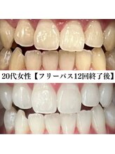 ホワイト 福岡天神店(WHITE)/ホワイトニングビフォーアフター