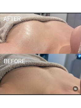 リボーン(Reborn)/バストアップ