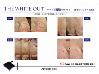 フォルトゥーナ ビューティー(Fortuna Beauty)の写真/本気の肌質改善はFortuna Beautyへお任せ♪毛穴引き締め＆シミケアフェイシャル導入☆乾燥する季節に◎