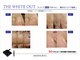 フォルトゥーナ ビューティー(Fortuna Beauty)の写真/本気の肌質改善はFortuna Beautyへお任せ♪毛穴引き締め＆シミケアフェイシャル導入☆乾燥する季節に◎